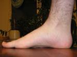 <img150*0:stuff/Naked_foot.jpg>