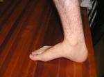 <img150*0:stuff/Normal_foot.jpg>