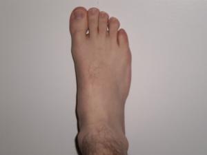 <img300*0:stuff/Right_close_up_.jpg>