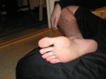 <img150*0:stuff/Sole_of_the_foot.jpg>
