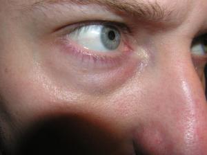 <img300*0:stuff/Staring_eye.jpg>