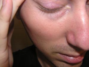 <img300*0:stuff/Strange_closed_eye._.jpg>