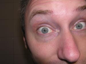 <img300*0:stuff/Surprised_eyes._.jpg>