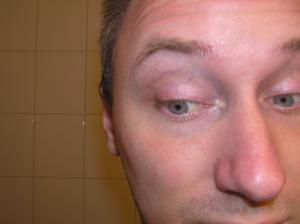 <img300*0:stuff/Surprised_eyes_looking_down._.jpg>