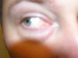 <img300*0:stuff/Wide_open_eye.jpg>