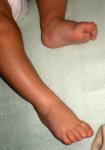 <img0*150:stuff/baby_feet_8_months_old.jpg>