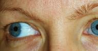 <img0*100:stuff/eyes%202%20side.jpg>