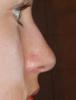 <img0*100:stuff/hnose2.jpg>