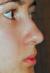 <img50*0:stuff/hnose3.jpg>