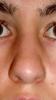 <img0*100:stuff/hnose4.jpg>