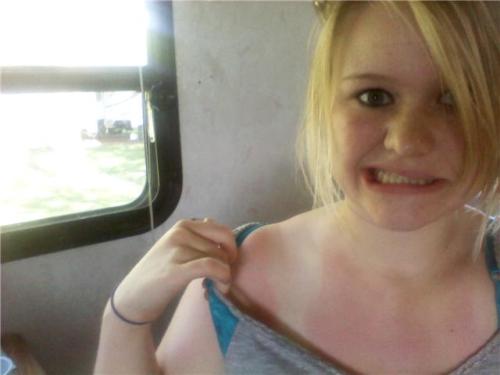 <img500*375:stuff/my_totally_wicked_sunburn.jpg>