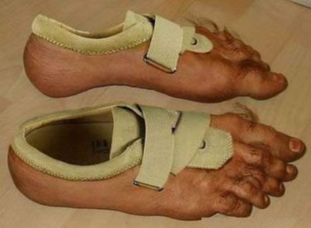 <img:stuff/nike_hairy-shoes.jpg>