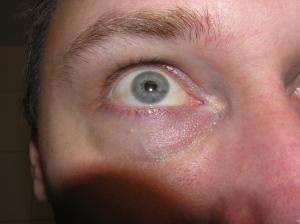 <img300*0:stuff/staring_eye..jpg>
