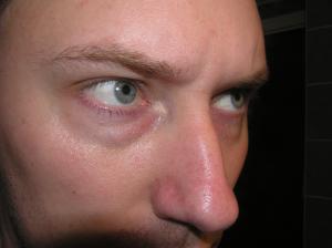 <img300*0:stuff/z/1/Eye%2520Photos/p1010001.jpg>