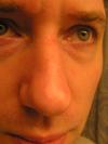 <imgr100*0:stuff/z/1/Hedda%2527s%2520face%2520reference%2520photos/p1010003.jpg>