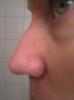 <imgr0*100:stuff/z/1/Hedda%2527s%2520face%2520reference%2520photos/p1010005.jpg>