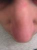 <imgr0*100:stuff/z/1/Hedda%2527s%2520face%2520reference%2520photos/p1010006.jpg>