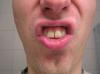 <img100*0:stuff/z/1/Hedda%2527s%2520face%2520reference%2520photos/p1010012.jpg>
