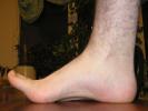 Foot Photo Reference