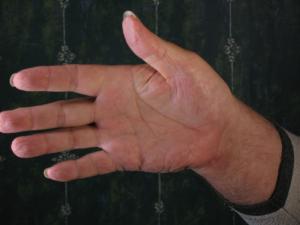<img300*0:stuff/z/10620/1-07-08%2520Hands/1-07-09%20012.jpg>