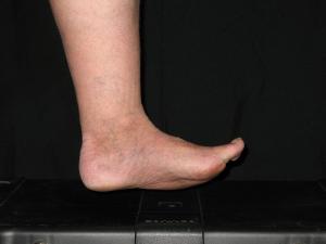 <img300*0:stuff/z/10620/EPRM%2520Skydancer%2520Feet/11-28-08%20Feet%20008.jpg>