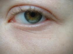 <img250*0:stuff/z/169023/Eye%2520Stock/i1256078758_1.jpg>