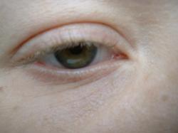 <img250*0:stuff/z/169023/Eye%2520Stock/i1256078758_2.jpg>