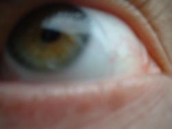 <img250*0:stuff/z/169023/Eye%2520Stock/i1256078758_4.jpg>