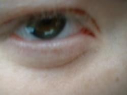 <img250*0:stuff/z/169023/Eye%2520Stock/i1256078759_11.jpg>