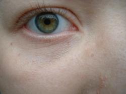 <img250*0:stuff/z/169023/Eye%2520Stock/i1256078759_14.jpg>