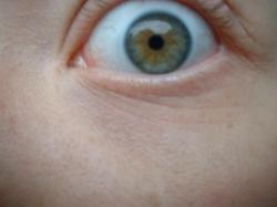 <img250*0:stuff/z/169023/Eye%2520Stock/i1256078759_20.jpg>