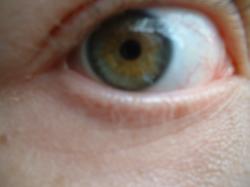 <img250*0:stuff/z/169023/Eye%2520Stock/i1256078759_21.jpg>