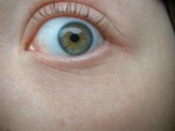 <img250*0:stuff/z/169023/Eye%2520Stock/i1256078759_26.jpg>