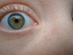 <img250*0:stuff/z/169023/Eye%2520Stock/i1256078760_32.jpg>