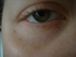 <img250*0:stuff/z/169023/Eye%2520Stock/i1256078760_36.jpg>