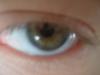<img100*0:stuff/z/169023/Eyes24/i1258576045_11.jpg>