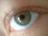 <img100*0:stuff/z/169023/Eyes24/i1258576045_12.jpg>