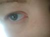 <img100*0:stuff/z/169023/Eyes24/i1258576045_4.jpg>