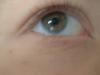 <img100*0:stuff/z/169023/Eyes24/i1258576045_6.jpg>