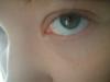 <img100*0:stuff/z/169023/Eyes24/i1258576045_9.jpg>
