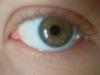 <img100*0:stuff/z/169023/Eyes24/i1258576046_16.jpg>