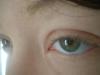 <img100*0:stuff/z/169023/Eyes24/i1258576046_18.jpg>