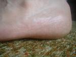 <img150*0:stuff/z/169023/Feet41/i1258664835_10.jpg>