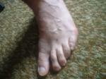 <img150*0:stuff/z/169023/Feet41/i1258664835_4.jpg>