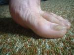 <img150*0:stuff/z/169023/Feet41/i1258664835_6.jpg>