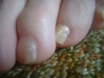 <img150*0:stuff/z/169023/Feet41/i1258664835_8.jpg>