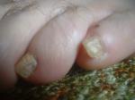 <img150*0:stuff/z/169023/Feet41/i1258664836_14.jpg>