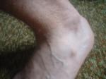 <img150*0:stuff/z/169023/Feet41/i1258664836_16.jpg>