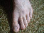 <img150*0:stuff/z/169023/Feet41/i1258664836_20.jpg>