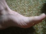 <img150*0:stuff/z/169023/Feet41/i1258664837_30.jpg>